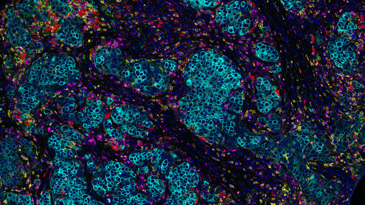 New method to integrate spatial transcriptomics datasets - Insight ...